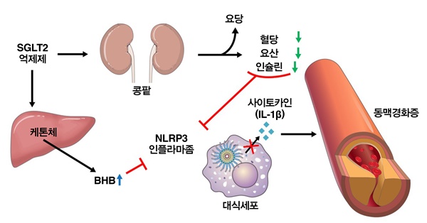 SGLT2 억제제는 콩팥을 통해 요당을 배출하도록 도와 혈액 내 포도당과 요산, 인슐린 수치를 낮춰 NLRP3 인플라마좀 활성을 억제한다. SGLT2 억제제는 또, 간에서 케톤체를 생성해 혈액 내 β-하이드록시부티르산(BHB)을 증가시켜 NLRP3 인플라마좀을 억제하는 것으로 이번 연구에서 밝혀졌다. 억제된 NLRP3은 대식세포내 사이토카인의 생산을 줄이는 것으로 확인됐다. 사이토카인은 죽상동맥경화증을 유발한다.