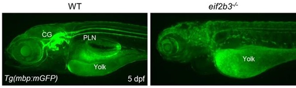 실험에서는 ‘EIF2B3’ 유전자 결핍 동물모델(오른쪽)은 그렇지 않은 동물모델(왼쪽)에 비해 신경계 미엘린 생성 결핍 증상을 보였다.(세브란스병원 제공).