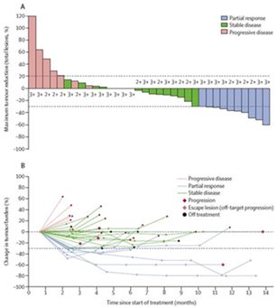 (그림설명) Trastuzumab과 FOLFOX치료를 받은 HER2-양성 담도암 환자별 종양 축소율(A)과 치료 진행에 따른 종양 크기 변화(B).